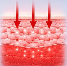 Illustration of 660nm red light interacting with the skin surface layers